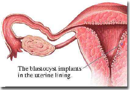 Eine Blastozyste, die sich in die Wand der Gebärmutter eingenistet hat