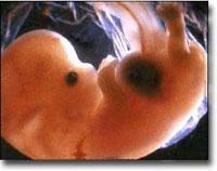 Ein 7 Wochen alter Embryo