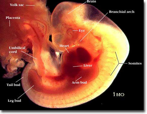 Ein 1  Monate alter Embryo ohne erkennbare menschliche Merkmale